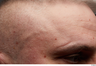  HD Face Skin Yury eyebrow face forehead skin pores skin texture wrinkles 0003.jpg
